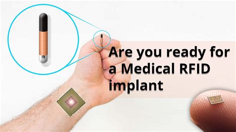 rfid chip hand|dangers of microchipping humans.